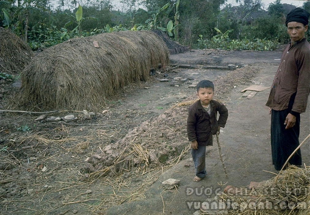 Miền Bắc Việt Nam 1967. Một bé trai bị cụt chân do không kích dùng cành cây chống nạng đứng cạnh bố.